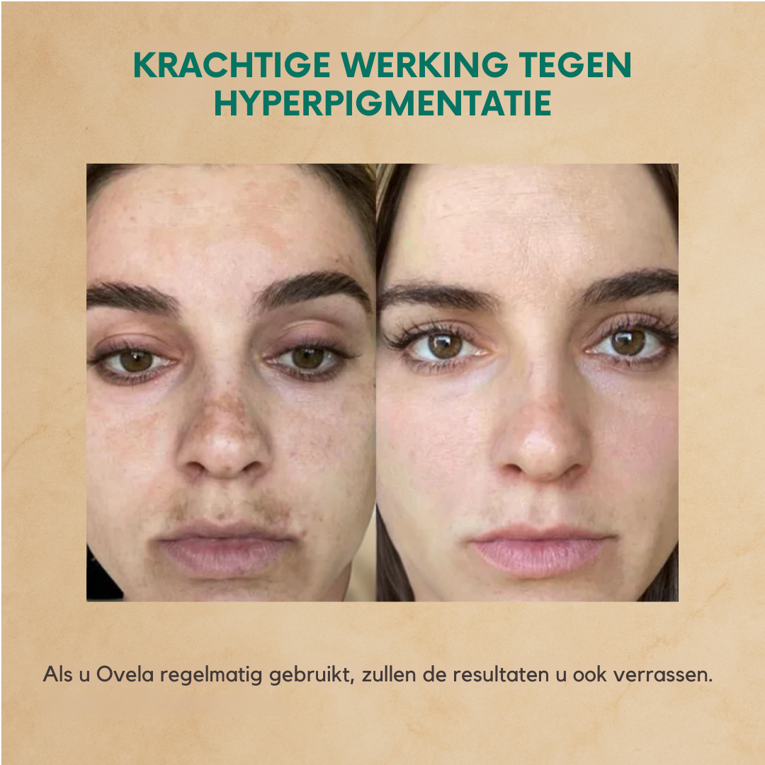 Ovela Anti-Aging Staartvet Crème