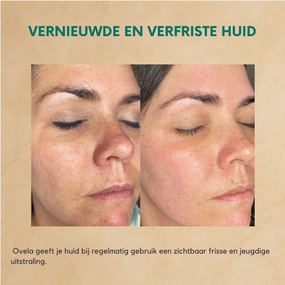 Ovela Anti-Aging Staartvet Crème