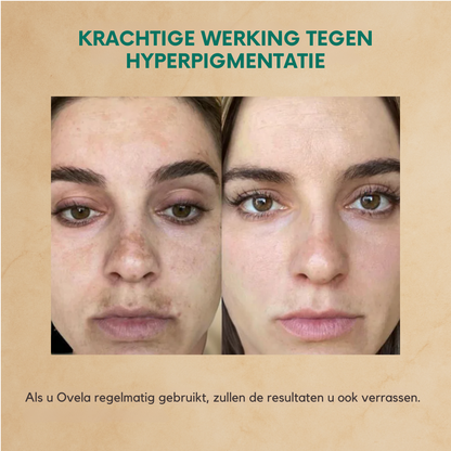 Ovela Anti-Aging  Staartvet Crème
